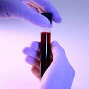 Hands holding test tube with red liquid