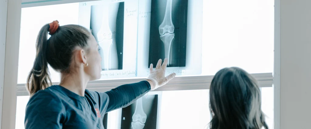 A radiography student wearing gloves points at a set of X-ray images displayed on a lightbox while discussing findings with a classmate. The images show detailed scans of knee joints, with handwritten notes for analysis. This hands-on learning experience helps students develop critical skills in medical imaging and patient diagnostics as part of their radiologic technology training.
